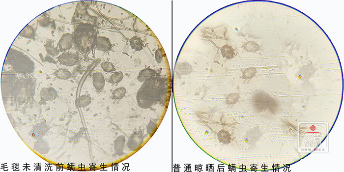 2400倍显微镜除螨除菌实测：美的H20WY烘干机=衣物净化器+除螨除菌仪?