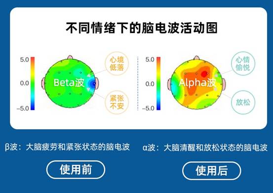 心诺即眠睡眠仪智能电子助睡助眠仪催眠仪器促进改善睡眠缓解失眠神器_G3s智能睡眠仪【CES疗法_APP记录睡眠数据】【图片_价格_品牌_报价】-京东_2d422e5692e8c90c